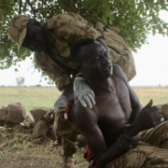 A rebel from the Sudan People's Liberation Army-North (SPLM-N) is treated for a gunshot wound sustained during the battle for Al-Hemer. His arm was amputated a day later.
